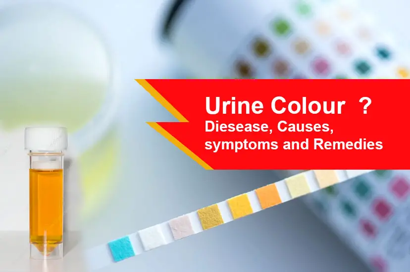 Urine Color Diesease