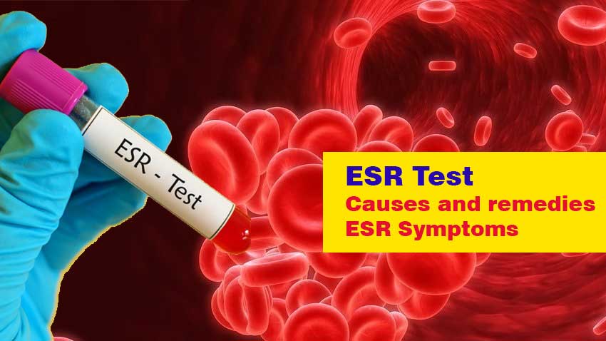 ESR Test